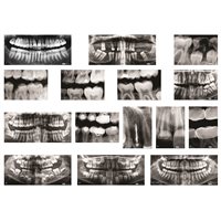 Radiographies dentaires - Paquet de 10